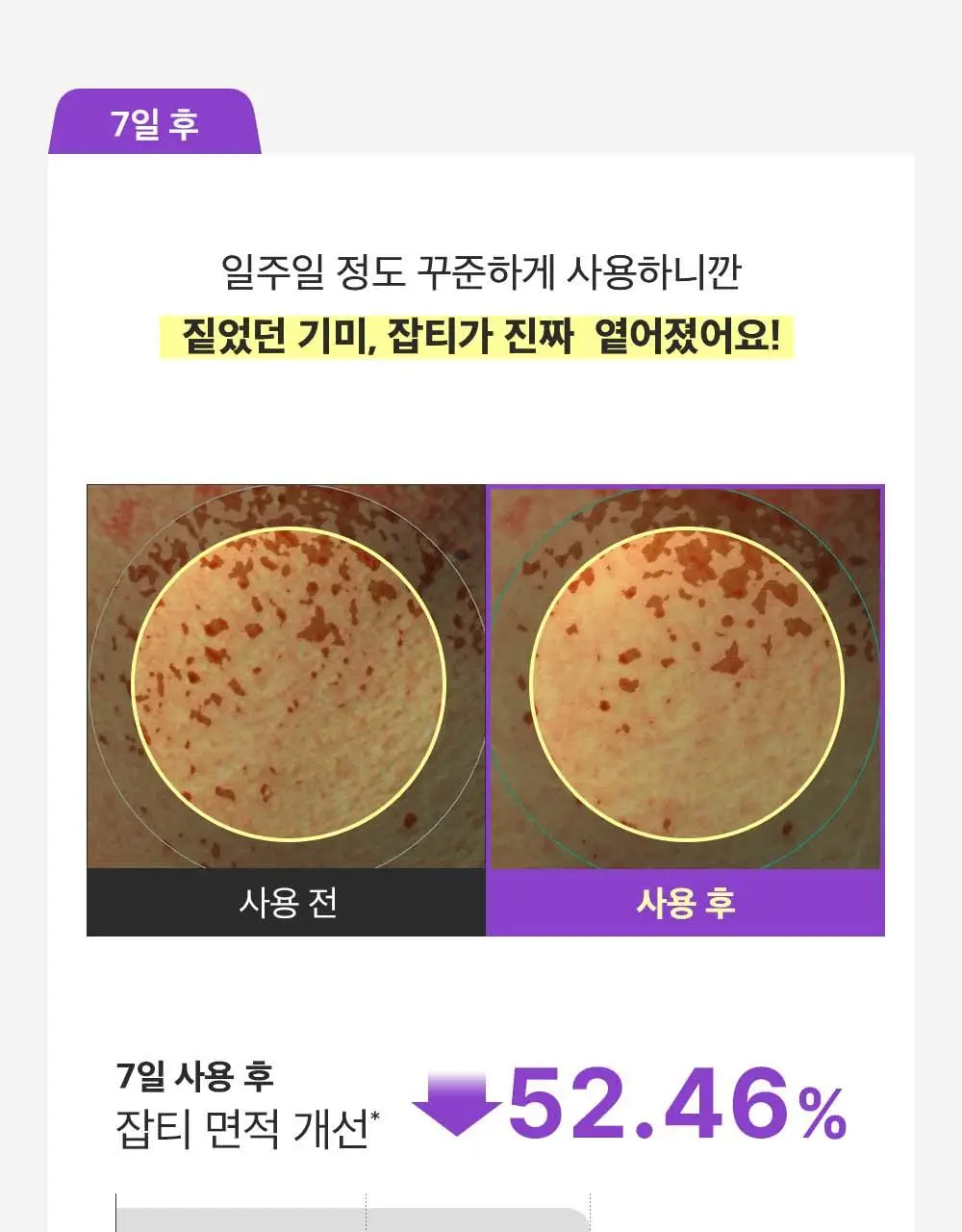 [포켓몬 에디션/잡티미백]성분에디터 머루포도 비타씨 다크 스팟 앰플 40ml 더블기획* 상세페이지 35